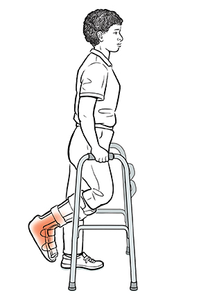 Person using walker, standing with knee bent to raise injured foot behind, with healthy foot just inside walker legs, ready to move walker forward for a step using non-weight bearing technique.