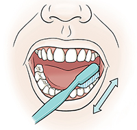 Closeup of mouth showing toothbrush brushing behind top incisors.